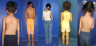 Vật lý trị liệu cho bé - Chăm sóc y tế Đức Hạnh : dt  0902 878 936